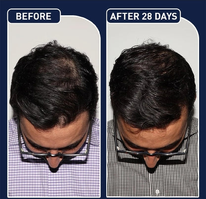 FEG Plus Hair Growth Serum Grow Longer, Thicker & Healthier Hair – Naturally