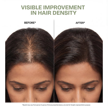 Proskire Ultimate Hair Growth Oil