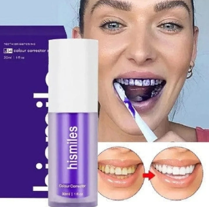Teeth Whitening Serum – Instant Purple Tooth Brightening Solution